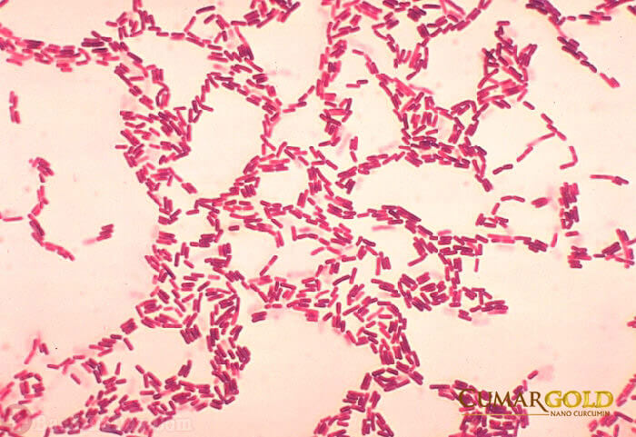 vi khuẩn helicobacter pylori khi nhuộm soi