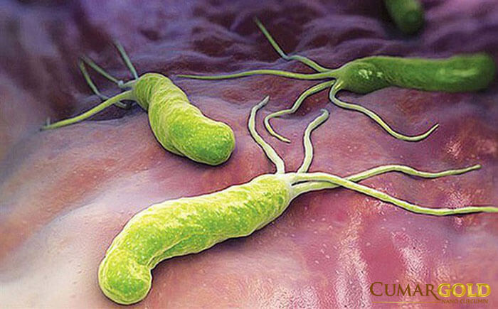 vi khuẩn Helicobacter Pylori dính chặt niêm mạc dạ dày