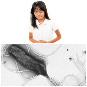 Nhiễm vi khuẩn HP ở trẻ em : 5 điều cơ bản cần biết