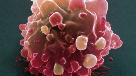 Ung thư có di truyền không và cách phòng ngừa ung thư