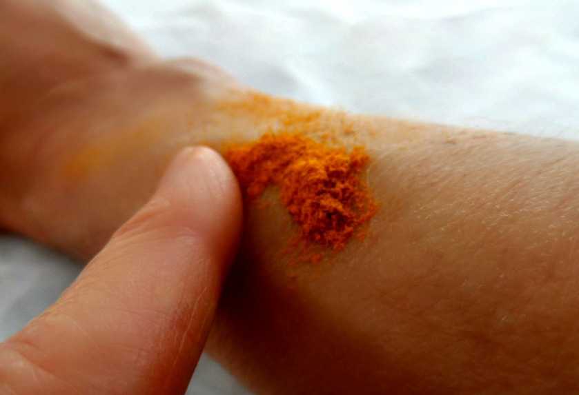 Công dụng tinh bột nghệ: chữa lành các vết thương trên da