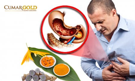[TOP 3] Cách Uống Tinh Bột Nghệ Chữa Đau Dạ Dày Hiệu Quả
