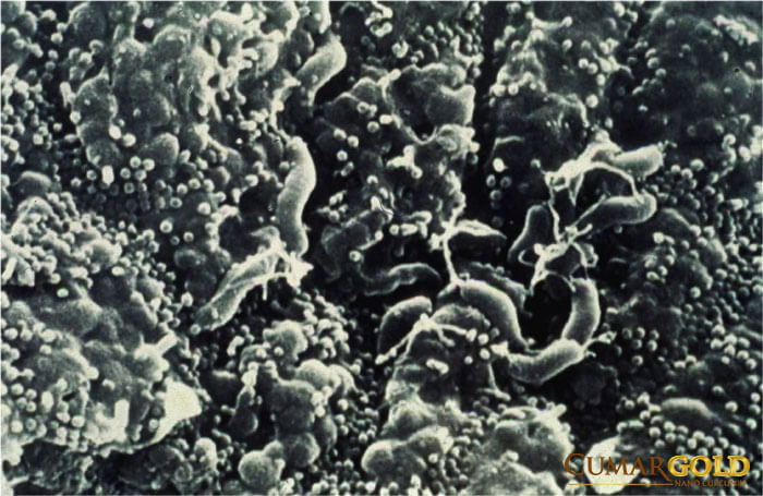 vi khuẩn helicobacter pylori dưới kính hiển vi điện tử