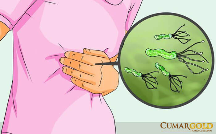 Hình ảnh minh họa vi khuẩn HP trong dạ dày