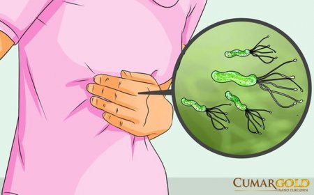 Vi Khuẩn HP Có Gây Ung Thư Không? [GIẢI ĐÁP CHI TIẾT]