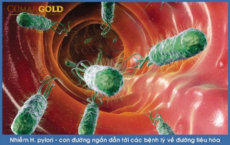 6 thông tin đặc biệt quan trọng bạn cần biết khi bị nhiễm vi khuẩn HP dạ dày