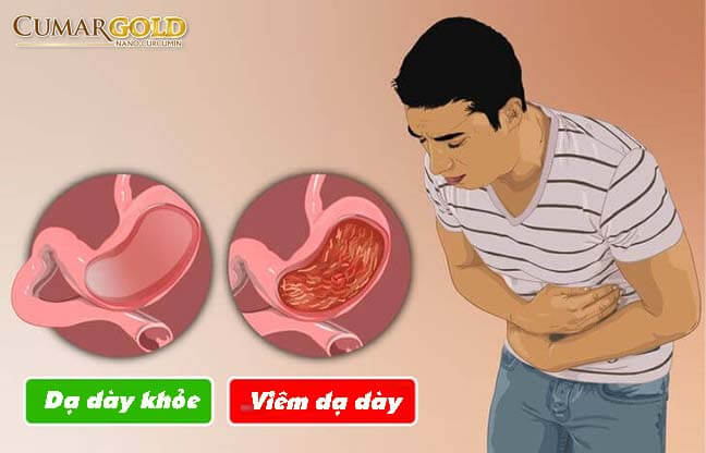 Viêm dạ dày là gì?