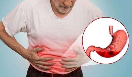 Xuất huyết dạ dày – triệu chứng và nguyên nhân gây bệnh